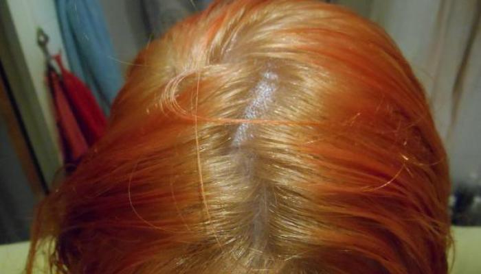 Как осветлить рыжие волосы Волосы после обесцвечивания стали рыжими